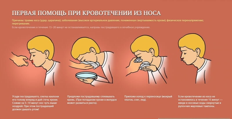 первая помощь при носовом кровотечении
