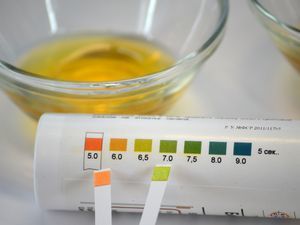 Что делать если у ребенка развивается ацетонемический синдром? Причины и рекомендации по лечению