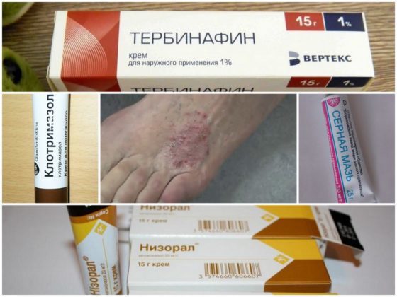 Список мазей от грибка ногтей на ногах: эффективные и недорогие препараты